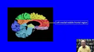 Freedman, Morris -  TMS to Enhance Psi Using Mind Matter Interactions as a Model