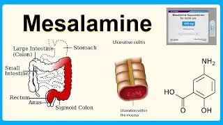 mesalamine