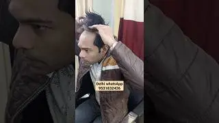 Besharam #shorts #trending #ytshorts #hairstyle #viral #new #hairpatch #wig #nicehairwig