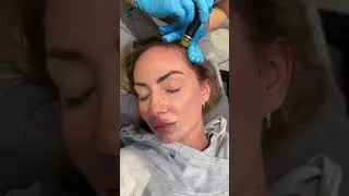 Keravive Scalp Treatment in San Antonio Texas at Cutella Medical Spa, the Best Medical Spa in Texas!