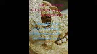 ANTERIOR ETHMOIDAL FORAMEN