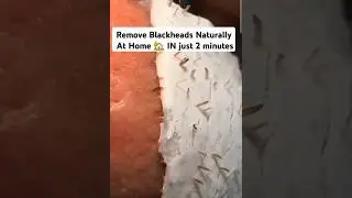 😱 Remove Blackheads Naturally At Home 🏡 IN just 2 minutes #skincare #beauty #beauty