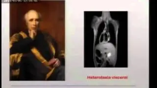 Sesión General - Cardiopatías Congénitas