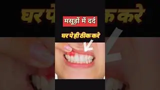 Masudon Ki Sabhi Problems Ke Liye Gharelu Upaye? Gum Problem Solution At Home