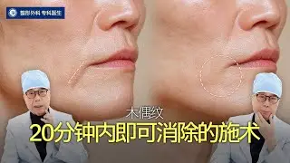 【包括中文字幕】当提拉，填充对木偶纹无效时，可以试试仅需“20分”即可解决的方法
