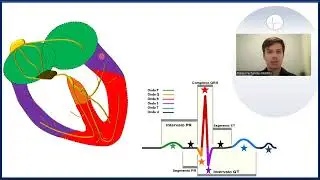 Como laudar o eletrocardiograma 1/4 (reconhecendo o ECG)