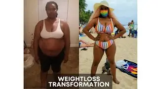 VSG: 1 YEAR POST OP UPDATE| I Regret Getting Surgery 😭😢😩