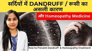 &ldquo;Winter = More Dandruff | &ldquo;Why Dandruff Gets Worse in Winter | Homeopathic Solutions&rdquo;