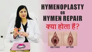 What is Hymenoplasty surgery ? Hymen Repair/ Re-Virgination surgery || Female Cosmetic Gynecologist