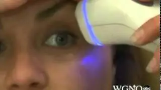 PaloVia Laser...A Beauty Breakthrough