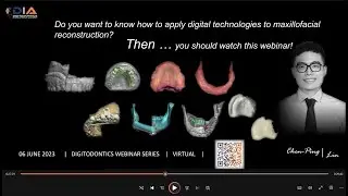 Digitodontics Webinar Series#7-2023 | Dr. Chen-Ping Lin | Digitized maxillofacial reconstruction
