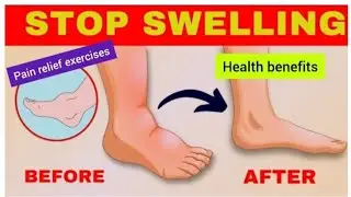 Live - feet exercises, थॉयराइड, पीसीओड, मोटापा, कब्ज, बीपी, कोलेस्ट्रॉल,fat, pain relief 06/11/2025