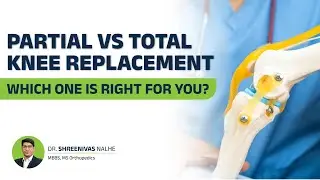 Partial vs Total Knee Replacement Surgery | Dr Shreenivas Nalhe