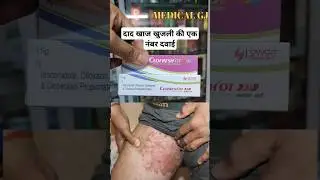clofresh ot cream | दाद खाज खुजली की क्रीम #medical #medical #skincare #khujli #khujlikailaj #shorts