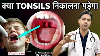 क्या Tonsils निकलवाना सही है? जानिए Tonsillectomy के सही Indications By Dr Anurag Prasad