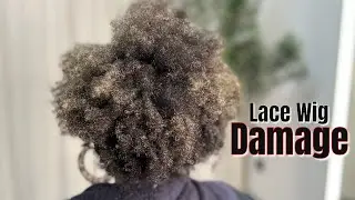 She Lost Her Edges to Lace Fronts &hellip; Watch the Transformation 