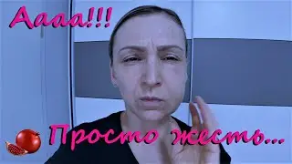 🇺🇦🇩🇪Зубні імпланти.