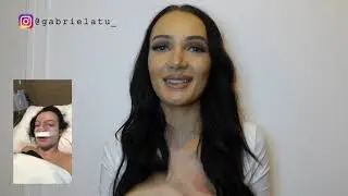 My rhinoplasty experience in Turkey (Nose job)