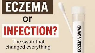 Eczema or Infection? The Swab That Gave Us Hope