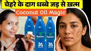 Pigmentation, Dark Spots, Melasma &ndash; Sabka Ek Desi Ilaj 🔥💯