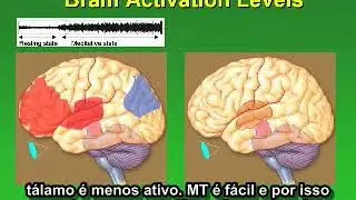 Diferen&ccedil;as entre as t&eacute;cnicasmeditacoes   Dr  Fred Travis