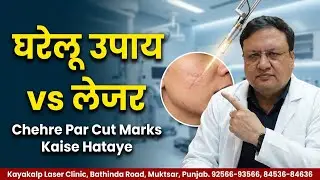 घरेलू उपाय या लेजर ट्रीटमेंट &ndash; क्या है बेहतर? Chehre Par Cut Marks Kaise Hataye