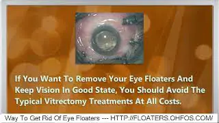Floaters In Left Eye While Pregnant