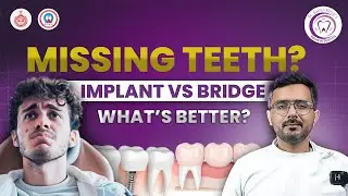 Dental Implant vs Dental Bridge | Best Tooth Replacement Option Explained
