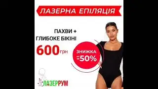 Лазерна епіляція Київ