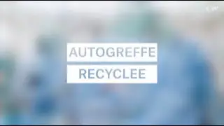 L&rsquo;autogreffe osseuse recycl&eacute;e : le couteau suisse de la chirurgie oncologique