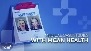 PLASTIC SURGERY TURKEY | MCAN HEALTH MEDICAL CASE STUDIES