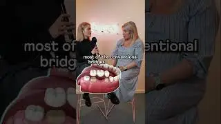 🦷🌉 What are the different types of dental bridges? - #dentist #qanda #dental #bridge #types