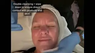 VI Chemical Peel with Blair