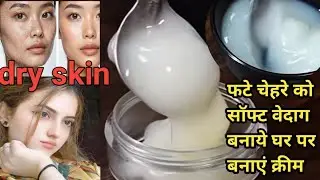 Dry skin चेहरे के दाग धब्बे कालापन झुरिया सब दूर करने वाली क्रीम घर पर बनाए दो बार में समस्या खत्म 👌