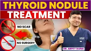 Thyroid Nodule (गले मे गाँठ) Cancer या Normal? | Thyroid Nodule Treatment Without Surgery