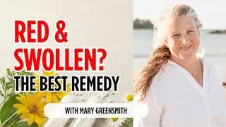 Ep 18. Intense Gout Pain? This Homeopathic Remedy Works Fast