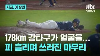NC 마무리 임지민, 178.7㎞ 강타구가 얼굴 직격…