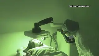 New treatment for birthmarks, rosacea, being tested in China