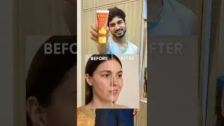 Vicco Turmeric Sandalwood Cream Review | Natural Skin Glow?