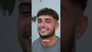 SOLLI JAY SHARES HIS TREATMENT JOURNEY WITH YOU.  #emaxcrowns crowns  #smilemakeoverturkey 🤩