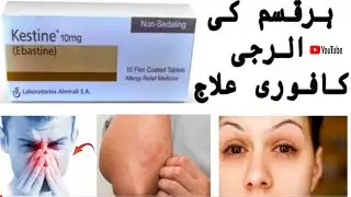 how to use Kestine tablet 10 mg uses Benefits Side Effects complete review in urdu hindi