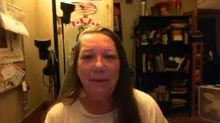 Bells palsy update 7 mths