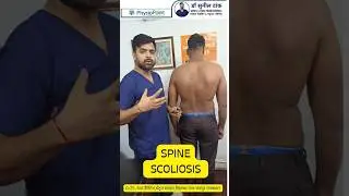 scoliosis chiropractic  treatment in #jaipur #drsuniltank #chiropractor #backpain