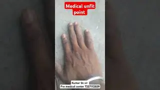 Medical unfit point ।। SSC GD medical ।। CPO SI medical ।। Army medical #sscexam #ssccgl #sscboard