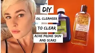 EASY DIY Acne Clearing Cleansing Oil