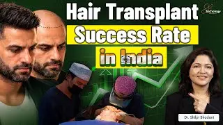 Will Your Hair Transplant Work? | Hair Transplant Success Rate in India | Dr. Shilpi Bhadani