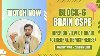 Inferior view of Brain | Model and Flashcards | Block 6 | Neuroanatomy | OSPE | Brain