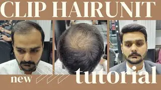 Chand Raat Ko New Hair Patch Ka Kaam & Hair Patch Service Ki jaye Gi | Falak Hair Club | Rawalpindi