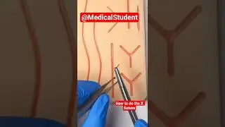 Stitching method #tips #hospital @MedicalStudentMBBS86