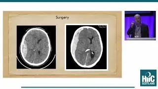 Michael Canty - The Neurosurgical Management of Paediatric TBI